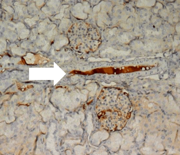 intracellular drug delivery on kidneys